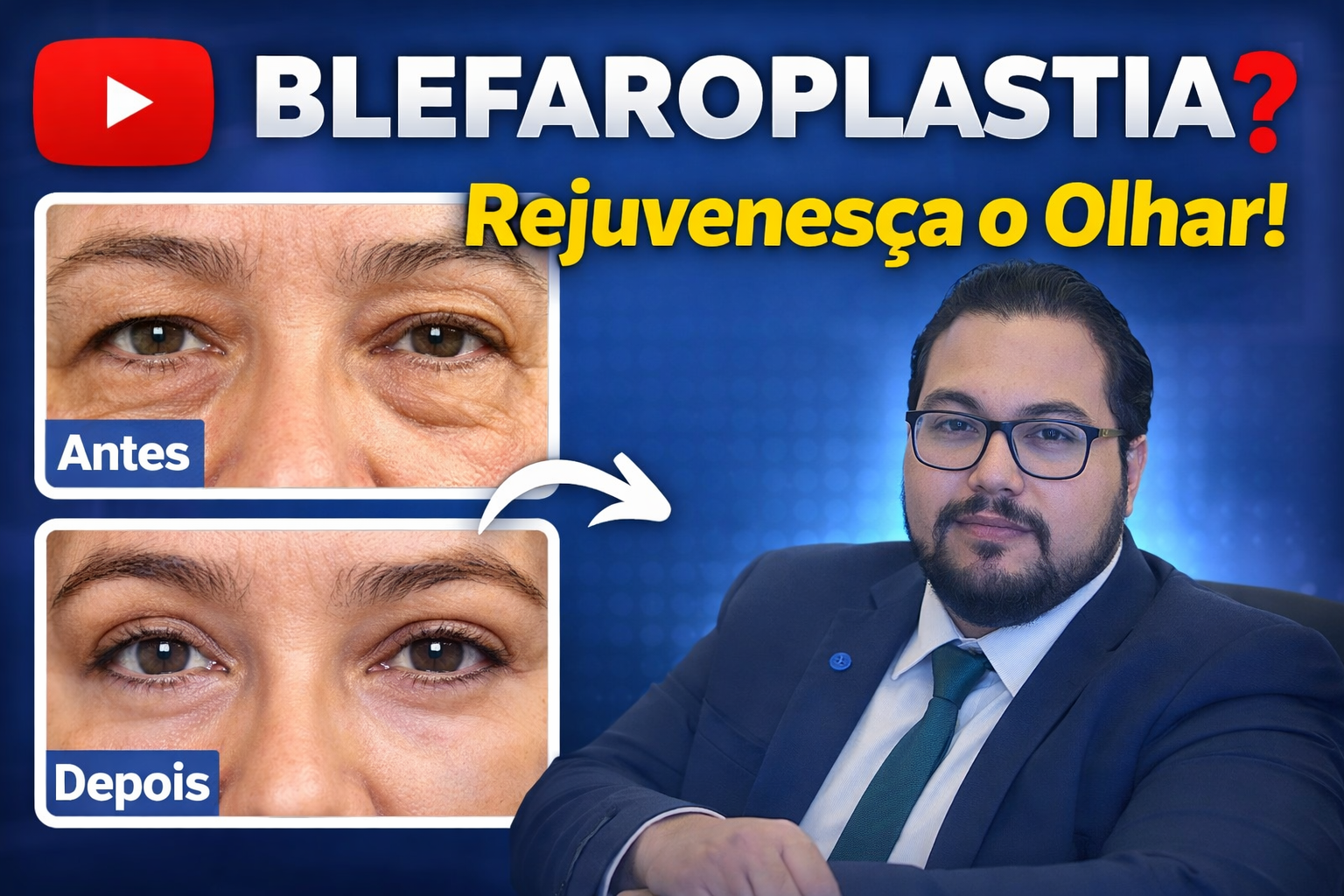 Blefaroplastia: O que você precisa saber